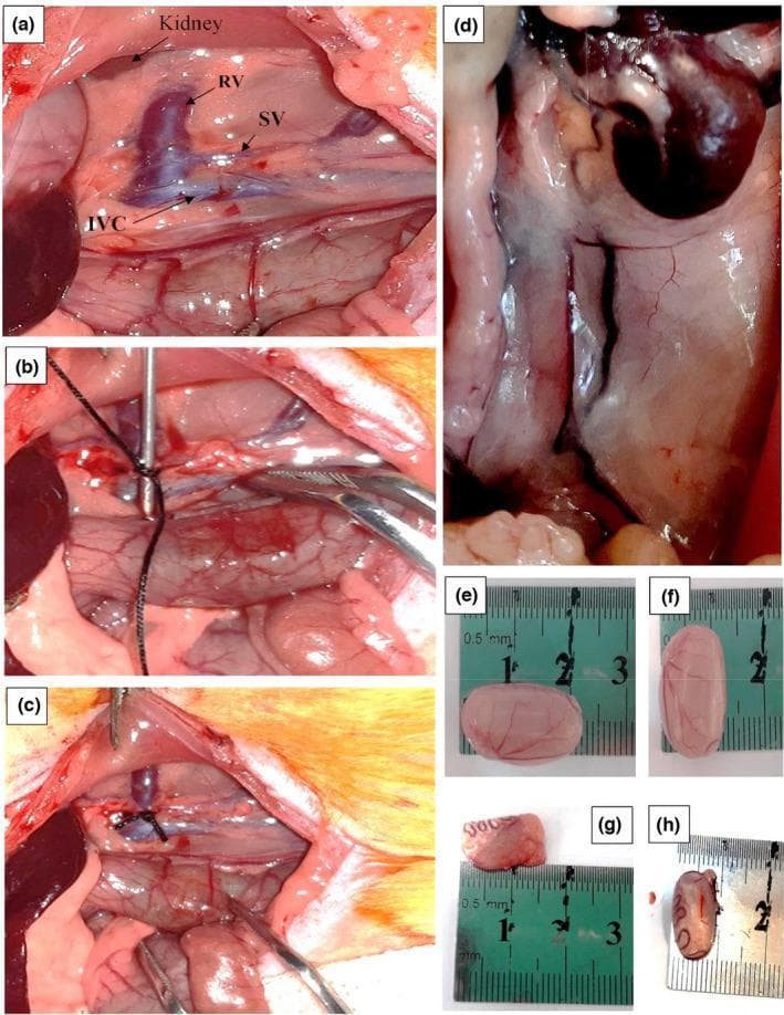 A multi-panel series of clinical photographs and gross specimens from an animal model study on varicocele. Panels (a) through (c) depict the surgical induction of varicocele via partial ligation of the left renal vein. Key anatomical landmarks labeled include the kidney, renal vein (RV), spermatic vein (SV), and inferior vena cava (IVC). Panel (b) illustrates the placement of a suture around the renal vein and a metal probe to ensure calibrated narrowing, while panel (c) shows the final surgical site after probe removal. Panel (d) displays a high-magnification clinical view of induced varicocele, characterized by a pale, dilated, and tortuous spermatic vein. Panels (e) through (h) compare excised testes measured against a ruler. Panels (e) and (f) show healthy control testes with normal morphology and size (~2 cm). Panels (g) and (h) demonstrate significant testicular atrophy in the varicocele group, with specimens appearing markedly smaller, shrunken, and discolored compared to the control group. The educational focus is on the anatomical pathways of venous drainage and the pathological progression of varicocele to testicular atrophy.