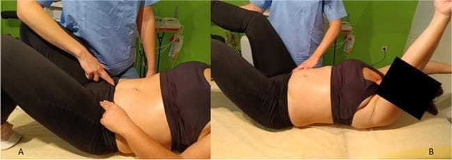 Two-panel clinical photograph demonstrating the activation and progression of the transversus abdominis (TrA) muscle during physical therapy. Panel A shows a patient in the supine hook-lying position (knees flexed, feet flat). A physiotherapist in blue scrubs is performing manual palpation of the lower abdominal wall, specifically just medial to the anterior superior iliac spine (ASIS), to assess the abdominal drawing-in maneuver (ADIM). The patient is also shown self-palpating on the contralateral side to monitor muscle tension. Panel B illustrates a progression of this stabilization exercise, where the patient maintains TrA contraction while introducing distal extremity movements. The patient is shown with the left leg extended and elevated and the right arm flexed overhead (crossed pattern). The physiotherapist maintains manual contact near the pelvic girdle to provide proprioceptive feedback and monitor trunk stability. This procedure is commonly used in postpartum rehabilitation for diastasis recti abdominis (DRA) and core stability training to ensure deep muscle engagement without excessive intra-abdominal pressure.
