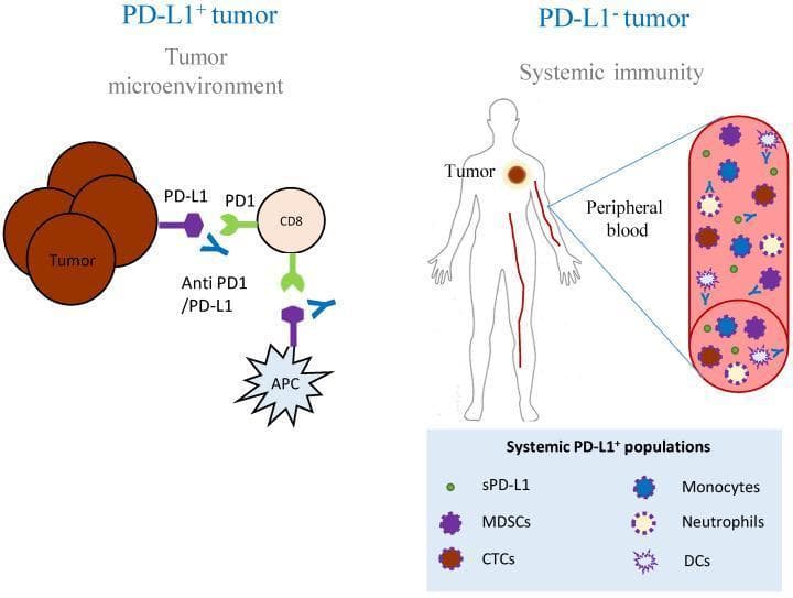 This medical pathophysiology diagram illustrates the role of PD-L1 expression in cancer immunotherapy, specifically comparing a PD-L1 positive tumor microenvironment (TME) with systemic PD-L1 expression in patients with PD-L1 negative tumors. The left panel shows a PD-L1 positive tumor where tumor cells and antigen-presenting cells (APCs) utilize the PD-L1/PD-1 pathway to inhibit CD8+ T cells. Therapeutic anti-PD1/PD-L1 antibodies are depicted blocking these interactions to restore immune response. The right panel illustrates the concept of 'Systemic Immunity' in a PD-L1 negative tumor context, featuring a human silhouette with an enlarged view of peripheral blood. This section identifies systemic PD-L1 positive populations that may influence clinical responses even when the primary tumor is PD-L1 negative. These populations include soluble PD-L1 (sPD-L1), myeloid-derived suppressor cells (MDSCs), circulating tumor cells (CTCs), monocytes, neutrophils, and dendritic cells (DCs). This diagram highlights the significance of the myeloid compartment and circulating biomarkers in patient stratification for immune checkpoint inhibitor (ICI) therapy in oncology.