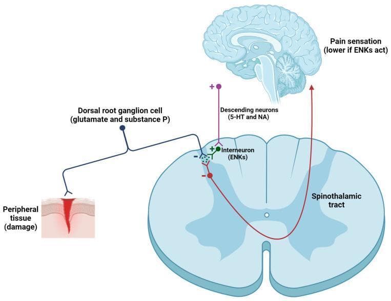 This pathophysiology diagram illustrates the modulation of the nociceptive pathway in the spinal cord, specifically the role of enkephalins (ENKs) in pain gating. The visual depicts three primary components: the ascending pain pathway, the descending inhibitory pathway, and the central nervous system structures (spinal cord cross-section and brain). The process begins with peripheral tissue damage activating a dorsal root ganglion (DRG) primary afferent neuron, which releases excitatory neurotransmitters glutamate and substance P into the dorsal horn. This signal is transmitted via the spinothalamic tract to the brain, resulting in pain sensation. Simultaneously, the diagram shows a descending inhibitory pathway originating from the brain (serotonergic 5-HT and noradrenergic NA neurons) that positively stimulates a spinal interneuron containing ENKs. These ENKs provide inhibitory feedback (noted by '-' signs) onto both the primary afferent terminal and the second-order ascending neuron. This enkephalinergic modulation effectively reduces the transmission of nociceptive signals to the cortex, resulting in a lower perception of pain. The diagram is an educational resource for understanding Gate Control Theory and opioid-mediated analgesia.