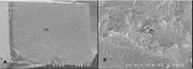 This diagnostic image consists of two Scanning Electron Microscopy (SEM) micrographs showing the microstructural analysis of a dental fractured surface. The visuals demonstrate a failure in the adhesive bond between restorative material and tooth structure. Image A, at 100x magnification, provides a macro-view of the fractured surface, labeled 'HL' for Hybrid Layer, which appears as a relatively uniform and smooth region with subtle linear striations. Image B, at a much higher 10000x magnification, reveals the topographical details of the same hybrid layer, showcasing a granular, rough, and porous micro-architecture. These images are clinically significant in dentistry for evaluating the quality of dentin bonding and characterizing the mode of failure—in this case, an adhesive failure predominantly involving the hybrid layer. The comparison between the two magnifications illustrates the difference between gross surface continuity and microscopic irregularities essential for assessing dental material performance and bond integrity.