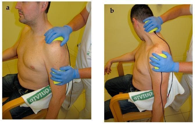 This clinical photograph illustrates the application of bipolar Interferential Therapy (IFT) electro-massage for musculoskeletal rehabilitation. The image is split into two panels: (a) showing the procedure with the patient in a neutral, upright seated position, and (b) demonstrating the procedure combined with active/passive stretching of the neck and shoulder musculature. A clinician wearing blue nitrile gloves is shown manually applying two yellow sponge-covered rubber electrodes to the patient's cervical-scapular and glenohumeral regions. The sponges are dampened to facilitate conductivity and smooth gliding over the skin during the massage. This technique is typically used in physical therapy to manage post-operative pain (such as after acromioplasty), improve range of motion, and target muscle groups like the upper trapezius and levator scapulae. The visual highlights the dynamic integration of electrotherapy with manual stretching to enhance therapeutic outcomes in the neck-shoulder complex.