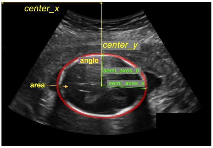 This diagnostic ultrasound image demonstrates a cross-sectional view of a fetal head in the second trimester, a key component of prenatal biometry. The image features a red elliptical overlay used to calculate the Head Circumference (HC), a critical metric for assessing gestational age and fetal growth. The fetal skull is visualized as a bright, hyperechoic curvilinear boundary, while the intracranial contents show characteristic heterogeneous, lower-echo patterns. Geometric annotations illustrate the automated or manual measurement process: 'center_x' and 'center_y' define the spatial coordinates of the head; 'semi_axes_a' and 'semi_axes_b' represent the major and minor radii (biparietal and occipitofrontal diameters); 'angle' denotes the orientation; and 'area' signifies the total surface area within the ellipse. The image contains inherent ultrasound artifacts, including speckle noise and acoustic shadowing. This visual material is primarily used for training in obstetric ultrasonography and the development of automated medical imaging algorithms for fetal health monitoring.