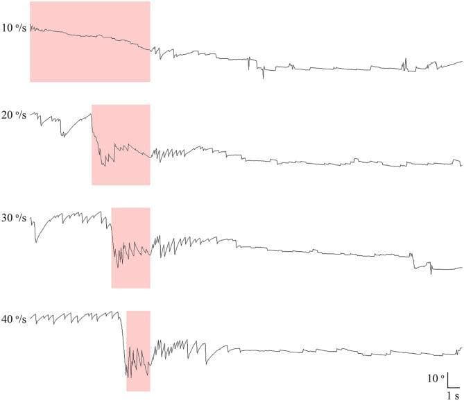 This diagnostic image displays four electronystagmography (ENG) or videonystagmography (VNG) recordings of vertical eye motion in a patient undergoing a motorized rotation chair test. The traces correspond to four different head rotation velocities: 10°/s, 20°/s, 30°/s, and 40°/s. Each recording depicts paroxysmal downbeat nystagmus (DBN) induced during a positioning phase, indicated by shaded pink rectangular areas. There is a direct correlation between rotation velocity and nystagmus intensity; as the velocity increases from 10 to 40°/s, both the amplitude and frequency of the downward deflections (downbeat nystagmus) increase significantly. Following the cessation of positioning, the paroxysmal downbeat nystagmus typically transitions into a lower-amplitude upward deflection, representing a brief upbeat nystagmus. A scale bar at the bottom right indicates 10° for vertical displacement and 1 second for time. This visual aids in understanding the velocity-dependent nature of central positional nystagmus (CPN) and its diagnostic patterns in neuro-otology.