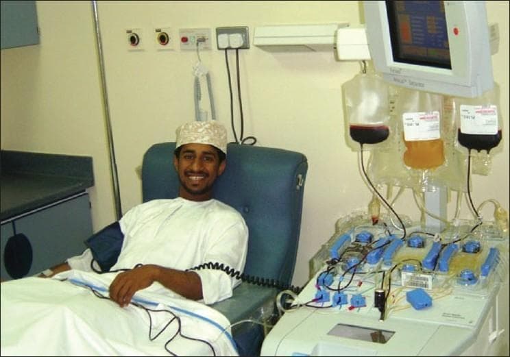 A clinical photograph depicting an apheresis procedure, specifically plateletapheresis, in a hospital or blood bank setting. A male donor is seated in a specialized blue reclining donor chair, connected to an automated blood cell separator (apheresis machine). The setup illustrates the extracorporeal circuit: blood is drawn through an intravenous line in the donor's arm, processed via a series of peristaltic pumps and a centrifugal separation chamber, and then returned. The machine features a monitoring screen and hangs several collection and infusion bags, containing red blood cells and amber-colored plasma or platelets, indicating the separation of blood components. A blood pressure cuff is visible on the donor's arm for monitoring hemodynamic stability during the procedure. This visual demonstrates the clinical application of medical technology in transfusion medicine for the collection of high-purity blood components like single-donor platelets.