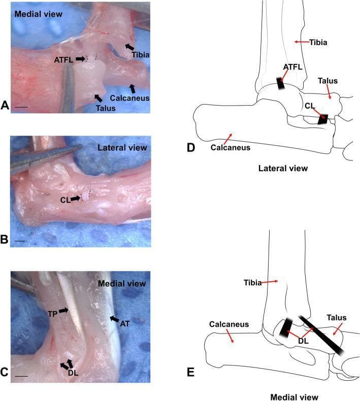 This composite educational image illustrates the anatomy of the ankle and subtalar joint ligaments using a mouse model, featuring three micro-dissection photographs (A-C) and two corresponding anatomical diagrams (D-E). Panel A presents a medial view identifying the anterior talofibular ligament (ATFL) situated between the fibula and talus. Panel B provides a lateral view highlighting the cervical ligament (CL) within the sinus tarsi region. Panel C shows the medial perspective of the ankle, specifically labeling the deltoid ligament (DL) complex along with the posterior tibial tendon (TP) and the Achilles tendon (AT). The anatomical diagrams (D and E) serve as schematic guides to the spatial orientation of these structures: Diagram D depicts the lateral anatomy including the ATFL and CL relative to the tibia, talus, and calcaneus, while Diagram E focuses on the medial deltoid ligament (DL) and its bony attachments. These visuals demonstrate ligamentous landmarks essential for orthopedic research, particularly in studies of joint stability and post-traumatic osteoarthritis. Scale bars represent 1 mm.