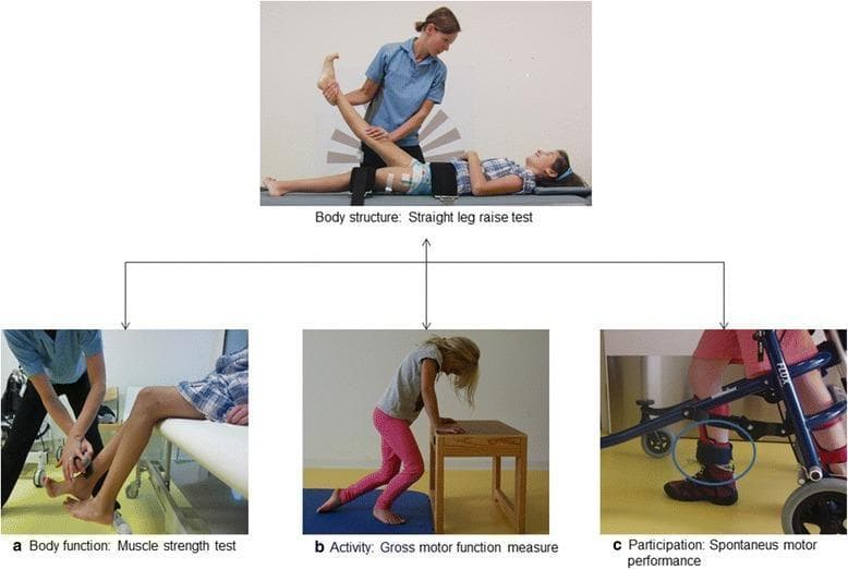 A composite medical illustration and clinical photograph series demonstrating pediatric physical therapy assessments framed within the International Classification of Functioning, Disability and Health (ICF) domains.
Top panel: A clinical photograph shows the 'Body Structure' level via a Straight Leg Raise (SLR) test. A child lies supine with a stabilization strap across the pelvis while a therapist elevates one leg to assess hamstring flexibility or neural tension.
Bottom panel (Left - 'a'): 'Body Function' measurement using a hand-held dynamometer (microFET2) to evaluate knee extensor strength. The child is seated on a bench with legs dangling while a clinician applies resistance at the ankle.
Bottom panel (Middle - 'b'): 'Activity' domain illustrated by a child performing a component of the Gross Motor Function Measure-66 (GMFM-66), involving transitional movements using a small bench for support.
Bottom panel (Right - 'c'): 'Participation' level showing spontaneous motor performance. A child uses a gait trainer (walker) with a 3D accelerometer (Actiwatch) attached to the right ankle to track daily activity levels.
This image illustrates the comprehensive evaluation of motor disability in pediatric populations, likely related to cerebral palsy.