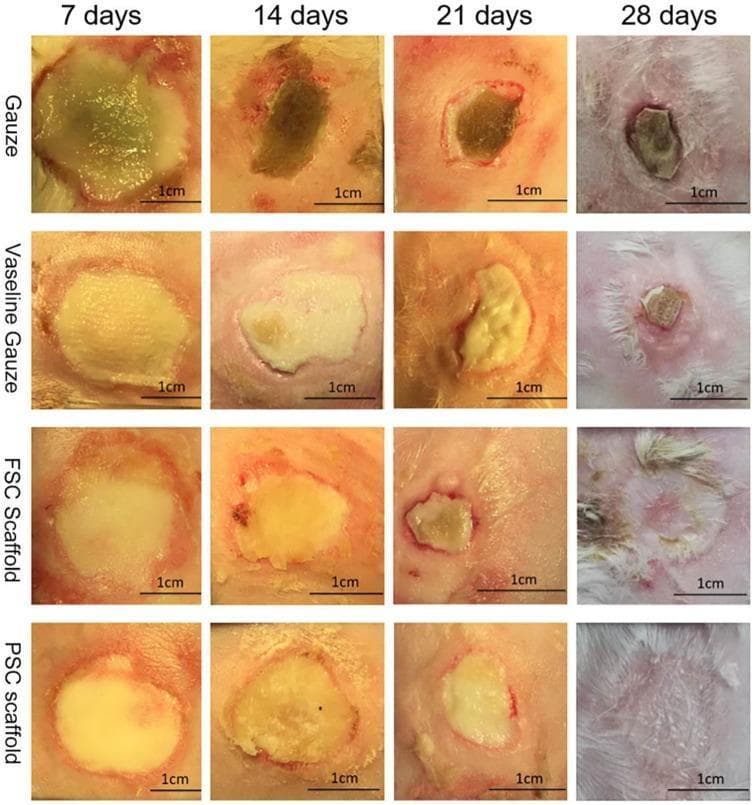 Hugging Face pmc clinical VQA raw