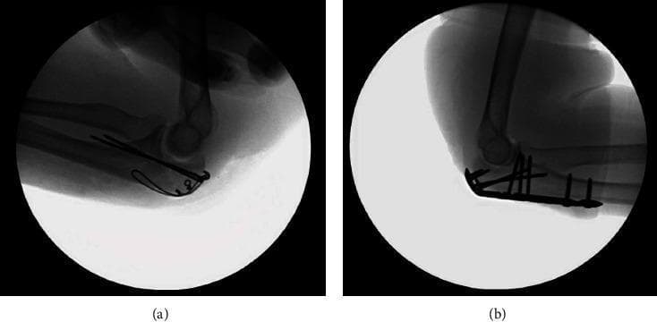 Hugging Face pmc clinical VQA raw