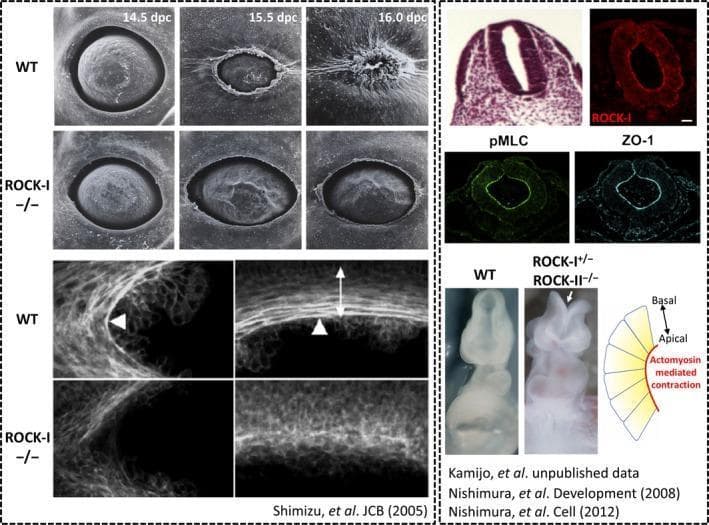 This composite educational image illustrates the role of Rho-associated coiled-coil containing kinase (ROCK) in embryonic development, specifically in eyelid and neural tube closure. The left panel features scanning electron micrographs (SEM) comparing eyelid morphogenesis in wild-type (WT) and ROCK-I−/− mouse embryos at 14.5, 15.5, and 16.0 days post-coitum (dpc). While WT eyelids successfully migrate and close, ROCK-I−/− embryos exhibit an 'eyes open at birth' phenotype. Below the SEMs, whole-mount immunofluorescence staining shows organized F-actin bundles (indicated by arrowheads) encircling the eye in WT embryos, which are significantly disrupted in ROCK-I mutants. The right panel demonstrates ROCK's involvement in neural tube closure. It includes H&E staining of a mouse embryo neural tube and immunofluorescence micrographs showing the localization of ROCK-I, phosphorylated myosin light chain (pMLC), and the apical marker ZO-1 along the apical surface of the neuroepithelium. A stereomicroscope comparison of 9.5 dpc embryos highlights impaired neural tube closure in ROCK-I+/−; ROCK-II−/− mutants. A schematic diagram summarizes the mechanism: ROCK-mediated actomyosin contraction at the apical surface facilitates tissue bending for morphogenetic closure.