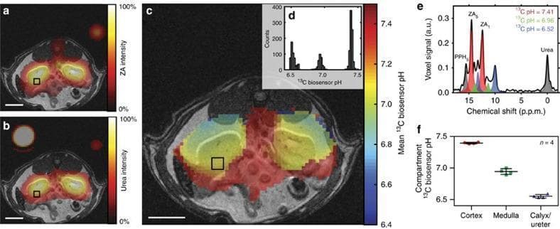 This composite educational graphic demonstrates in vivo metabolic imaging and pH mapping using hyperpolarized 13C magnetic resonance spectroscopy (MRS). The visual elements include axial MRI slices of a rat abdomen with color-coded signal overlays and corresponding quantitative data plots. Panels (a) and (b) show the high signal intensity of zymonic acid (ZA) and 13C-labeled urea concentrated in the kidneys. Panel (c) provides a mean pH map ranging from approximately 6.4 to 7.4, illustrating three distinct physiological compartments: the renal cortex (pH ~7.4, yellow/red), medulla (pH ~6.9, green), and calyx/ureter (pH ~6.5, blue). Panel (e) displays a voxel signal analysis revealing multiple spectral peaks (ZA5, ZA1, PPH5, and Urea). The multi-peak structure for ZA allows for the simultaneous detection of three pH clusters within a single voxel, categorized by chemical shift differences. Panel (f) summarizes the consistency of these pH measurements across different anatomical renal compartments. This material is designed for advanced medical imaging and physiology curricula, focusing on non-invasive metabolic monitoring and biosensor technology.
