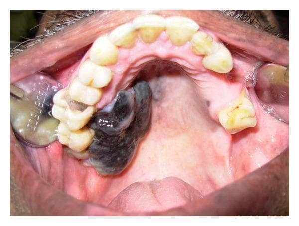 Hugging Face pmc clinical VQA raw