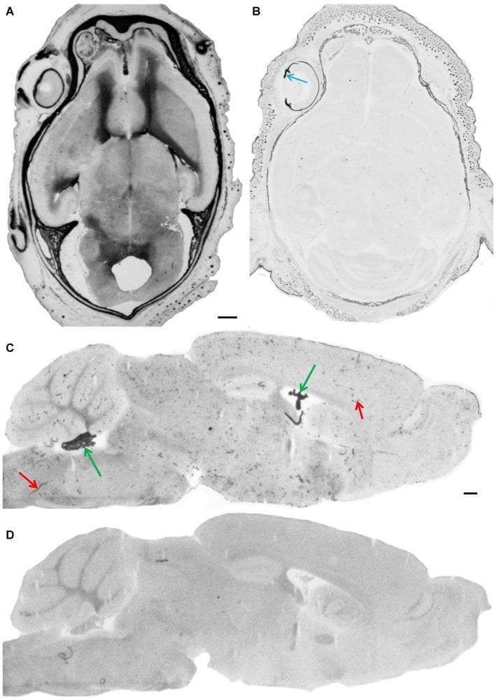This set of diagnostic images demonstrates the presence and experimental blockade of endogenous alkaline phosphatase (AP) activity in mammalian brain tissue. Images A and B show horizontal sections of a mouse embryo head (E18). In A, standard fixation reveals intense AP staining throughout the meninges and brain parenchyma. In B, alkaline fixation with EDTA successfully inactivates endogenous AP, leaving only pigmented structures like the iris (blue arrow) visible. Images C and D display parasagittal sections of an adult brain. In C, positive AP staining is localized in the choroid plexus (green arrows) and cerebral blood vessels (red arrows), illustrating the enzyme's distribution in the blood-brain barrier and blood-cerebrospinal fluid barrier interfaces. Image D shows the corresponding section with inactivated AP activity, resulting in a loss of specific staining in these vascular and epithelial structures. Scale bars indicate 0.5 mm. The content illustrates histological techniques for blocking background enzymatic activity to improve the specificity of immunohistochemical staining for tight junction proteins.