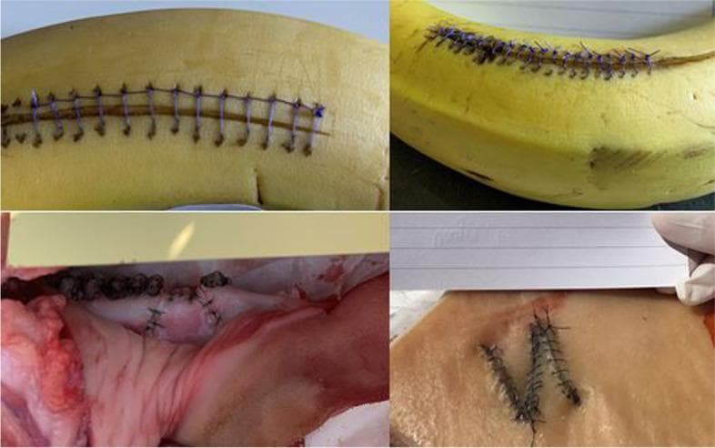 A composite of four clinical photographs demonstrating basic surgical suturing techniques performed on various simulation models. The top two panels show fruit models (bananas) used for practicing skin incisions and closure; the top-left demonstrates a simple interrupted suture pattern with blue synthetic monofilament, while the top-right shows a continuous running suture. The bottom-left panel depicts suturing on biological animal tissue (likely porcine), showing wound eversion and knot tying on irregular surfaces. The bottom-right panel displays a 'V-shaped' incision closure on a layered tissue model (likely chicken or synthetic skin), demonstrating local flap or complex laceration repair techniques using black braided sutures. These images illustrate common educational methodologies in medical and surgical training for developing manual dexterity, proper instrument handling, and wound management skills. The varying textures across models simulate different tissue tensions and biological resistances encountered during clinical procedures.
