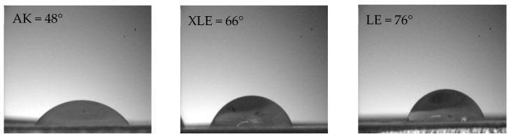 This diagnostic comparison image illustrates the surface hydrophilicity of three different loose reverse osmosis (RO) membranes—AK, XLE, and LE—via water contact angle measurements. The content consists of three grayscale goniometer frames showing water droplets on flat-sheet membrane surfaces.
1. The AK membrane displays a contact angle of 48°, showing the most significant droplet spreading and a flatter morphology, indicating the highest degree of hydrophilicity among the set.
2. The XLE membrane exhibits an intermediate contact angle of 66°, with the droplet showing a more defined hemispherical shape.
3. The LE membrane demonstrates the largest contact angle at 76°, where the droplet appears most spherical, reflecting lower wetting and relatively lower hydrophilicity.
In biomedical engineering and laboratory medicine contexts, these measurements are critical for assessing membrane fouling resistance and permeability during the separation of clinical analytes, such as lactic acid or salts, from biological fluids.