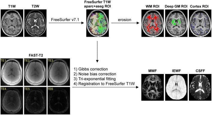 This diagram illustrates an automated neuroimaging post-processing pipeline for multi-compartment water fraction mapping. The process is divided into two main parallel streams. Stream 1 focuses on anatomical segmentation: T1-weighted (T1W) and T2-weighted (T2W) MRI inputs are processed via FreeSurfer v7.1 to generate an 'aparc+aseg' region of interest (ROI) map. Subsequent erosion operations create three refined binary tissue masks: cerebral white matter (WM), deep gray matter (GM), and cortex. Stream 2 involves processing FAST-T2 data across six echo times (TE1-TE6). This branch includes Gibbs correction, noise bias correction, tri-exponential fitting, and registration to the FreeSurfer T1W space. The final outputs of the pipeline are quantitative maps of compartmental water fractions: Myelin Water Fraction (MWF), Intra/Extracellular Water Fraction (IEWF), and Cerebrospinal Fluid Fraction (CSFF). The pipeline serves as a standardized method to quantify microstructural brain tissue changes and glymphatic clearance markers in research and clinical neuroimaging.