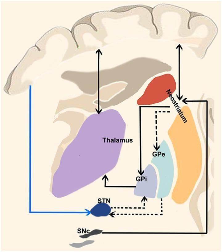 This medical schematic diagram illustrates the functional neuroanatomy of the human basal ganglia circuitry, detailing the classic motor loops. The diagram displays key anatomical structures including the cerebral cortex, thalamus (violet), neostriatum (red/orange), globus pallidus externa (GPe, light blue), globus pallidus interna (GPi, bluish-gray), subthalamic nucleus (STN, dark blue), and substantia nigra pars compacta (SNc, dark gray). Three primary functional pathways are highlighted: the Direct Pathway (solid black lines from neostriatum to GPi), which facilitates movement via disinhibition of the thalamus; the Indirect Pathway (dashed black lines connecting neostriatum to GPe, then STN, and finally GPi), which serves to inhibit motor activity; and the Hyperdirect Pathway (solid blue line from cortex directly to STN), which provides rapid inhibition of motor output by bypassing the striatum. Arrows indicate the direction of signal flow between these nuclei and the thalamocortical circuit, providing a visual model for understanding movement disorders like Parkinson's and Huntington's disease where these pathways are imbalanced.