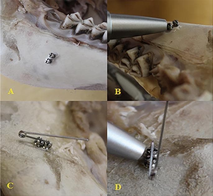 A series of four clinical photographs (A-D) demonstrating an experimental orthodontic stability setup using miniscrews in a bovine bone block. Image A shows two self-drilling miniscrews (1.6 x 8 mm) inserted parallel to each other into the bone surface, with their tissue-suppression platforms in close contact. Image B depicts the application of a Periotest 'M' device, with the metallic tip positioned perpendicular to the long axis of a single miniscrew to evaluate primary stability. Image C illustrates the 'Super-Torque System' (STS) configuration, where a 18” x 25” stainless steel rectangular wire acts as a horizontal retentive arm, passing through the slots of both miniscrews and secured with ligature wires engaged in the screw eyelets. Image D shows a close-up of the Periotest evaluation performed on the combined STS unit. This sequence demonstrates the biomechanical reinforcement of orthodontic anchorage by interconnecting multiple miniscrews to distribute horizontal forces and reduce micromovement, as measured by Periotest Value (PTV).