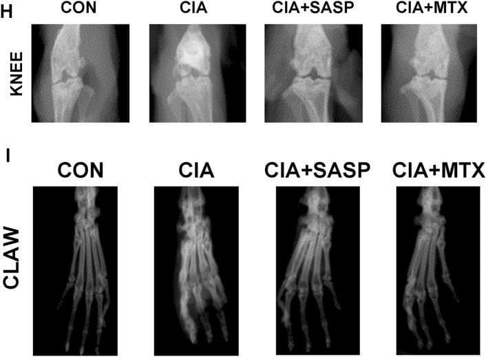 This diagnostic image set displays comparative radiographic views of mouse knee joints (Panel H) and claws (Panel I) within an experimental Rheumatoid Arthritis (RA) model. The content is organized into four comparative groups: Control (CON), Collagen-Induced Arthritis (CIA), CIA treated with Sulfasalazine (CIA+SASP), and CIA treated with Methotrexate (CIA+MTX). In the knee joint radiographs, the CON group shows clear joint spaces and smooth cortical margins. The CIA group exhibits joint space narrowing and articular surface erosion. Treatment groups (SASP and MTX) demonstrate partial preservation of the joint architecture. In the claw radiographs (Panel I), the CON group shows normal bone density and alignment of the phalanges and metacarpals. The CIA group displays signs of inflammatory bone destruction, characterized by decreased bone density and structural blurring. The CIA+SASP and CIA+MTX groups show improved bone integrity and better-defined skeletal structures compared to the untreated CIA group. These images illustrate the radiographic progression of RA-like joint damage and the therapeutic efficacy of DMARDs (disease-modifying antirheumatic drugs) in a preclinical mammalian model.