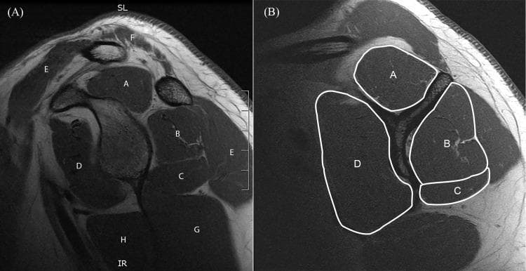 This diagnostic image consists of two panels showcasing sagittal T1-weighted MR-arthrography of the human shoulder, specifically focusing on the musculature of the shoulder girdle at the glenoid level. Panel A identifies anatomical landmarks: supraspinatus (A), infraspinatus (B), teres minor (C), subscapularis (D), deltoid (E), trapezius (F), triceps brachii (G), and teres major (H). The muscles appear as well-defined, intermediate-to-low signal intensity structures (dark gray) against the high-signal intensity (white) of intramuscular and subcutaneous fat. Panel B demonstrates a quantitative clinical assessment of the rotator cuff using cross-sectional area (CSA) measurements. White outlines delineate the CSA for the supraspinatus (A), infraspinatus (B), teres minor (C), and subscapularis (D) at the 'Y-position'—the lateral slice where the scapular spine and body converge. This visual serves as a standardized educational tool for orthopedic radiology and physical therapy to evaluate muscle atrophy, fatty infiltration, and rotator cuff integrity.