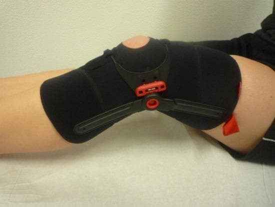 A clinical photograph of a specialized patellar realignment brace (Patella Pro) fitted on a human leg flexed at the knee. The device consists of a black neoprene-like compressive sleeve that extends from the distal thigh to the proximal calf, featuring a circular cutout for the patella. Centrally, a rigid tracking system is integrated over the knee joint, characterized by a semi-rigid black plastic frame with distinctive red adjustment nodes and tensioning components. Two articulated black bars extend laterally from the central tracking unit along the axis of the femur and tibia. The brace is designed to apply a medially directed force to the patella, counteracting lateral maltracking and tilt during the early stages of knee flexion (0°–30°). This orthopedic orthosis is primarily used in the management of patellofemoral pain syndrome (PFPS) to improve joint mechanics and reduce activity-related pain during rehabilitation.