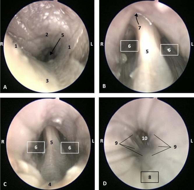 A series of four endoscopic images (A–D) detailing the anatomy of the pharyngeal cavity. Image A illustrates the oropharynx and the isthmus of the fauces, showing the arcus palatoglossus (1), soft palate (2), and tongue root (3). Image B provides a view of the laryngopharynx, highlighting the lingual surface of the epiglottis (5), the bilateral piriform recesses (6), and the superiorly located intrapharyngeal orifice (7). Image C further demonstrates the laryngopharyngeal structures, including the epiglottic vallecula (4), epiglottis (5), and piriform recesses (6). Image D captures the transition toward the esophagus, showing the oesophageal vestibule (8), the pharyngoesophageal limit (9), and the longitudinally folded oesophageal mucosa (10). The images showcase the healthy mucosal appearance, transitions in tissue texture between the pharyngeal and esophageal regions, and the spatial relationships between key landmarks such as the epiglottis and the piriform recesses, which are critical for understanding deglutition and airway protection.