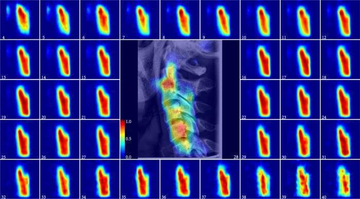 This composite educational graphic presents an Average Relative Distribution of Ageing (ARDA) salience map of the cervical spine across a developmental timeline from 4 to 40 years. The central focus is a lateral cephalometric radiographic (LCR) image of a 28-year-old subject overlaid with a color-coded heat map (blue to red gradient) indicating ageing-significant regions. The surrounding grid displays 37 individual heat maps representing the progression of ageing salience for each year of age. In early childhood (ages 4–9), the salience is broadly and diffusely distributed, reflecting rapid growth and developmental changes. As maturation occurs, particularly after age 12, the ageing salience becomes more localized and consistent. Red and dark red zones indicate high intensity salience, primarily concentrated in the vertebral bodies and the spinous processes of the C2–C5 vertebrae. Anatomical landmarks include the vertebral bodies C1 through C5. This visualization is used in forensic medicine and skeletal maturity assessment to identify specific regions of the cervical spine that provide diagnostic information for biological age estimation and physiological development tracking.