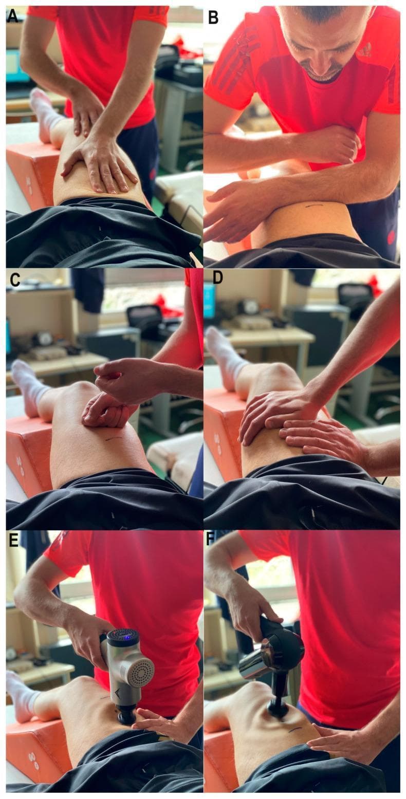A multi-panel clinical photograph collage demonstrating various manual and mechanical massage techniques applied to the rectus femoris muscle for sports recovery. Panels A-D illustrate manual massage (MM) techniques: (A) Effleurage, showing long, gliding strokes using the palms; (B) Friction, depicting deep circular or linear pressure using the forearms to move tissue over underlying structures; (C) Tapping (Tapotement), showing rhythmic percussion with the hands; and (D) Vibration, demonstrating fine oscillatory movements without breaking skin contact. Panels E and F showcase mechanical recovery tools: (E) Vibro-mechanical massage using a device with a wide, flat attachment to provide high-frequency oscillations; and (F) Percussive mechanical massage using a massage gun with a spherical head to deliver targeted, high-amplitude vertical strokes. The patient is positioned supine with the knee supported, typical for physical therapy and athletic training interventions focused on reducing muscle tension and enhancing neuromuscular contractile properties after fatigue.