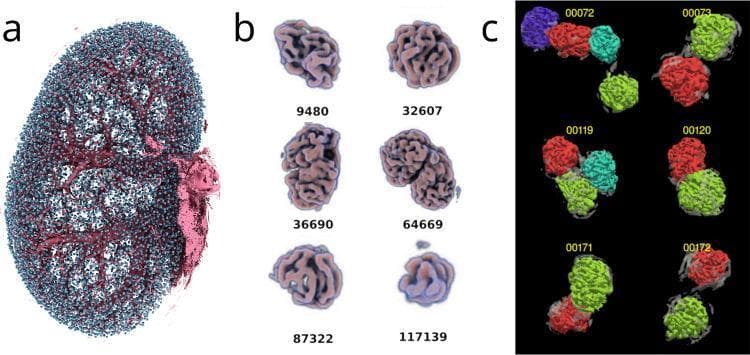 This composite educational graphic illustrates the results of advanced micro-tomography (SRµCT) and machine learning applied to renal micro-anatomy. Panel (a) shows a 3D volume rendering of an entire kidney, where thousands of individual glomeruli are mapped in cyan, densely populating the renal cortex. Large pre-glomerular blood vessels are rendered in magenta, providing a structural framework of the renal vasculature. Panel (b) provides a high-resolution gallery of individual volume-rendered glomeruli, identified by reference numbers. These renderings showcase the complex, convoluted capillary tuft morphology and the natural variation in glomerular size and shape. Panel (c) displays the results of morphometric analysis used to differentiate and separate clustered glomeruli that appear fused due to shared vascular connections, with individual units color-coded (red, green, cyan, purple) for distinction. This visual material is intended for advanced study in nephrology, specifically regarding glomerular filtration barrier architecture and quantitative renal morphometry.