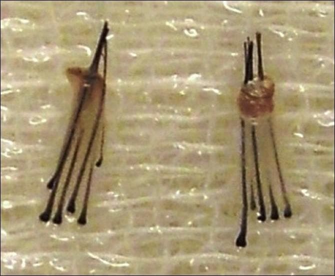 This clinical photograph shows two high-density follicular unit extraction (FUE) grafts used in hair restoration surgery. The macroscopic view demonstrates two distinct follicular units resting on a textured surgical surface. Each graft consists of multiple dark terminal hairs emerging from a common base of dermal and subcutaneous tissue. The graft on the left contains five terminal hairs, while the graft on the right contains six, illustrating the rare extraction of larger follicular units. The surrounding perifollicular tissue appears intact, semi-translucent, and slightly bulbous at the base, which is critical for graft viability and successful transplantation. The dark, rounded distal ends of the hair shafts are visible, along with uniform shaft thickness. This image serves as a teaching tool for dermatologists and hair transplant surgeons to identify graft integrity and composition following the use of micropunches (typically 0.8 to 1.0 mm) during the FUE procedure.