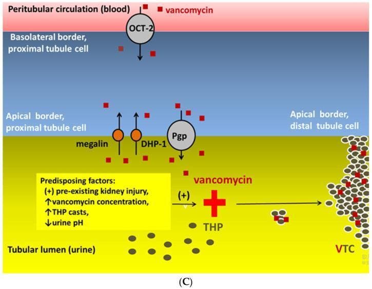 A medical pathophysiology diagram illustrating the formation of vancomycin-associated tubular casts (VTC) within the nephron. The schematic depicts four horizontal compartments: the peritubular circulation (blood), the proximal tubule cell (basolateral and apical borders), and the tubular lumen (urine). Vancomycin molecules, represented as red squares, are shown entering the proximal tubule cell from the blood via the OCT-2 (organic cation transporter 2) at the basolateral border. At the apical border, reabsorption is mediated by megalin and dehydropeptidase-1 (DHP-1), while P-glycoprotein (Pgp) facilitates transport between the lumen and distal tubule cells. In the tubular lumen, vancomycin interacts with Tamm-Horsfall glycoprotein (THP), leading to the formation of large VTC aggregates (indicated by a red plus sign). A yellow text box highlights predisposing factors for VTC formation, including pre-existing kidney injury, elevated vancomycin concentration, increased THP casts, and decreased urine pH. This diagram serves as an educational tool for understanding the localized necrotic and obstructive mechanisms of vancomycin-induced acute kidney injury (VA-AKI).