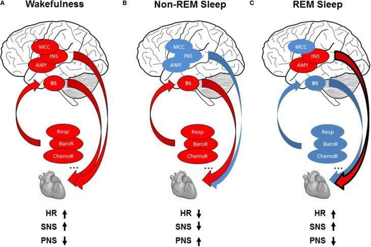 A multi-panel pathophysiology diagram illustrating autonomic cardiac regulation across three vigilance states: (A) Wakefulness, (B) Non-REM Sleep, and (C) REM Sleep. Each panel displays a sagittal brain view, reflex loop components (Respiration, Baroreflex, Chemoreflex), and the heart. Color-coding (red for increased activity/influence, blue for decreased) highlights state-dependent shifts. Wakefulness (A) shows high central autonomic network (CAN) activity in the midcingulate cortex (MCC), insula (INS), and amygdala (AMY), alongside active reflex loops, resulting in increased heart rate (HR) and sympathetic (SNS) tone with decreased parasympathetic (PNS) tone. Non-REM Sleep (B) depicts decreased CAN activity (blue) with maintained reflex loop dominance (red), leading to decreased HR/SNS and increased PNS tone. REM Sleep (C) shows a complex mix of high cortical activity (MCC/INS/AMY) and inhibited reflex loops/brainstem (BS) modulation, returning to a state of increased HR and SNS activity. The diagram demonstrates the dynamic interplay between central command and homeostatic reflexes in cardiovascular control during sleep-wake cycles.