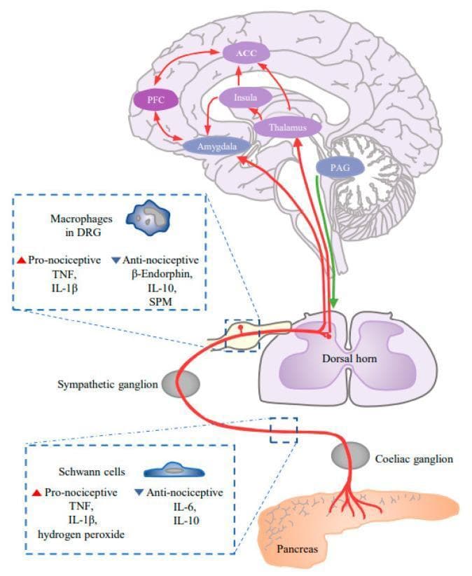 A pathophysiology diagram illustrating the pain conduction pathway in pancreatic ductal adenocarcinoma (PDAC), highlighting the transition from peripheral neurogenic inflammation to central sensitization. The pathway originates at the pancreas, where Schwann cells release pro-nociceptive (TNF, IL-1̠, hydrogen peroxide) and anti-nociceptive (IL-6, IL-10) factors. The signal traverses the coeliac ganglion and sympathetic ganglion to reach the dorsal horn of the spinal cord. Within the dorsal root ganglion (DRG), macrophages modulate the signal via pro-nociceptive (TNF, IL-1̠) and anti-nociceptive (B-Endorphin, IL-10, SPM) mediators. Ascending tracks project to the periaqueductal gray (PAG) in the brainstem, which then connects to a network of cortical and subcortical regions including the thalamus, amygdala, insula, anterior cingulate cortex (ACC), and prefrontal cortex (PFC). Red arrows denote ascending pain transmission, while green arrows indicate descending modulation. This diagram serves as an educational tool for understanding chronic pain mechanisms and synaptic remodeling in the central nervous system during pancreatic cancer progression.
