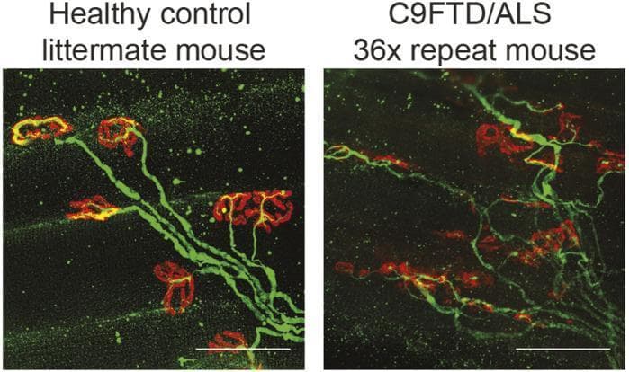 A side-by-side comparison of immunofluorescence diagnostic images showing neuromuscular junction (NMJ) pathology in a murine model of C9orf72 amyotrophic lateral sclerosis and frontotemporal dementia (ALS/FTD). The microscopy displays whole-mount staining of the extensor digitorum longus (EDL) muscle. Post-synaptic acetylcholine receptors are labeled with red ฮฑ-bungarotoxin, while pre-synaptic axons and motor nerve terminals are labeled with green neurofilament antibody. The 'Healthy control' panel shows highly organized, linear axonal projections terminating in distinct, continuous, and robust 'pretzel-like' motor endplates. In contrast, the 'C9FTD/ALS 36x repeat' panel demonstrates significant neurodegeneration characterized by disorganized, fragmented axonal branching and 'dissolving' boutons with reduced or sparse red fluorescence. This visual evidence highlights the pathophysiology of denervation and synaptic instability in motor neuron disease. Scale bars represent 50 ยตm.