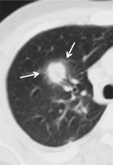 Hugging Face pmc clinical VQA raw