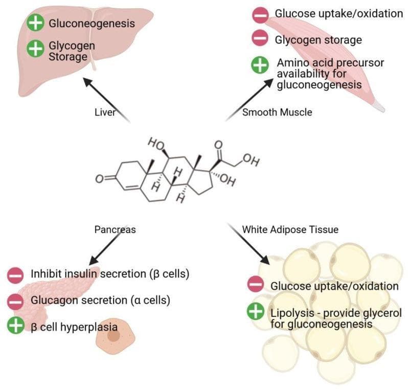 This pathophysiology diagram illustrates the systemic effects of cortisol on glucose metabolism across various human tissues. At the center is the chemical steroid structure of cortisol, with arrows indicating its multi-organ impact. 1) Liver: Shows increased (+) gluconeogenesis and glycogen storage. 2) Smooth Muscle: Depicts decreased (-) glucose uptake/oxidation and glycogen storage, but increased (+) amino acid precursor availability for gluconeogenesis. 3) Pancreas: Illustrates inhibition (-) of insulin secretion from beta cells and glucagon secretion from alpha cells, alongside induced (+) beta cell hyperplasia. 4) White Adipose Tissue: Shows decreased (-) glucose uptake/oxidation and increased (+) lipolysis, which provides glycerol for hepatic gluconeogenesis. The visual summarizes the hormonal role of glucocorticoids in mobilizing energy substrates and maintaining blood glucose levels, often associated with the metabolic response to stress. This educational material is suitable for students of endocrinology and metabolic physiology.