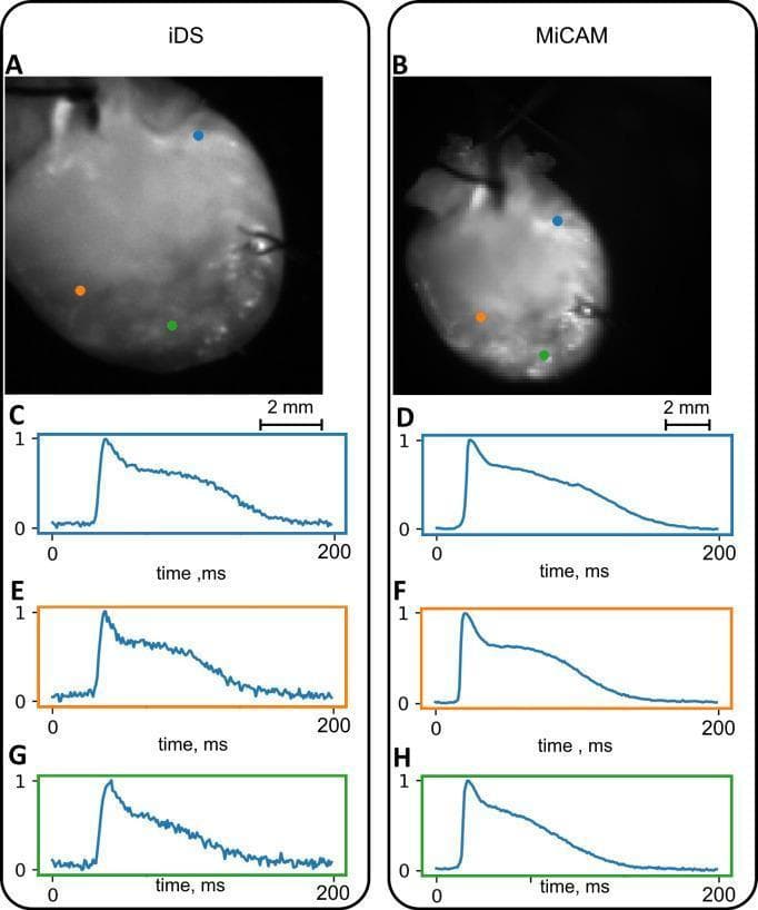 This Comparison Chart illustrates cardiac optical mapping data obtained from two different camera systems: the iDS (left column) and MiCAM (right column). Panels A and B display still frames of a Langendorff-perfused mouse heart, stained with a voltage-sensitive dye (Di-4-ANEPPS). Three color-coded pixels (blue, orange, and green) are marked on the ventricular surface of each heart image, indicating specific regions of interest. Panels C through H present the corresponding action potential (AP) waveforms recorded from these marked locations. The x-axis represents time in milliseconds (0–200 ms) and the y-axis shows normalized signal amplitude. The AP waveforms demonstrate characteristic cardiac electrophysiological phases, including rapid depolarization and subsequent repolarization. Visually, the iDS system images (A) appear brighter with a clearer anatomical outline but show higher high-frequency noise in the raw AP traces (C, E, G). In contrast, the state-of-the-art MiCAM system (B) produces traces with a higher signal-to-noise ratio (D, F, H), resulting in smoother AP curves. This comparison is used in cardiovascular research to validate the efficacy of lower-cost imaging systems for measuring cardiac activation sequences and action potential duration (APD).