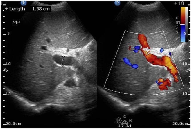 Hugging Face pmc clinical VQA raw