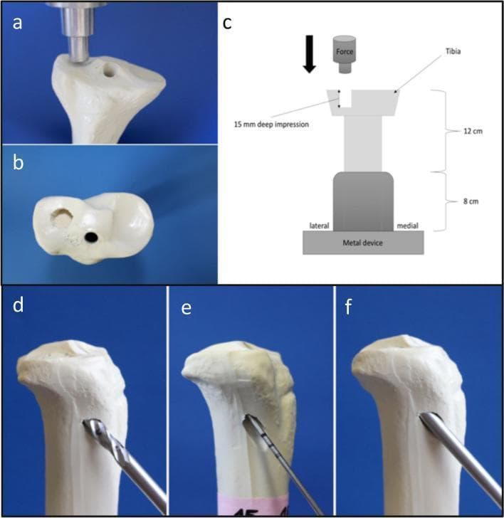 A multi-panel figure illustrating a biomechanical study of lateral tibial plateau depression fractures (Schatzker type III) using synthetic bone models. Panels (a) and (b) show the generation of a 15 mm deep depression fracture on the lateral tibial plateau using an axial indentor. Panel (c) provides a schematic diagram of the biomechanical test setup, showing a shortened tibia embedded in a metal device with axial force applied by a load cell. Panels (d), (e), and (f) demonstrate the step-by-step anatomical reduction process mimicking the Arthroscopic Reduction and Internal Fixation (ARIF) technique: (d) illustrates the lateral metaphyseal approach using a drill to create an entry point; (e) shows a Kirschner-wire (K-wire) used to detect and guide the depressed fragment; and (f) demonstrates the use of a cannulated ram to elevate the articular surface back to its anatomical position. This content serves to teach orthopedic trauma management, specifically the minimally invasive reduction of intra-articular proximal tibia fractures.
