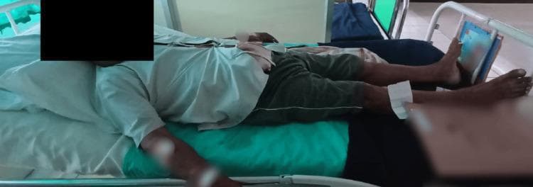 This clinical photograph illustrates a patient performing Jacobson's Progressive Muscle Relaxation (PMR) technique as part of a pulmonary or cardiac rehabilitation program. The patient is positioned supine in a hospital bed, with a white pillow under the head and a turquoise moisture-wicking pad beneath the torso. The arms are extended along the sides of the body with palms facing upward to facilitate full muscle relaxation. A white medical dressing is visible on the right lower leg, just below the knee, and a clinical chart is positioned at the foot of the bed. This visual demonstrates the application of non-pharmacological interventions for managing anxiety and respiratory stress in an inpatient setting. The technique focuses on the systematic tensing and subsequent relaxing of specific muscle groups to reduce physiological arousal. This image is relevant for physical therapy, cardiopulmonary rehabilitation, and psychiatric nursing education regarding stress-management protocols in clinical environments.