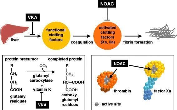 A multi-panel pathophysiology diagram illustrating the mechanism of action of oral anticoagulants on the coagulation cascade. The top panel shows a linear pathway: the liver produces functional clotting factors, which undergo coagulation to become activated clotting factors (Xa and IIa/thrombin), ultimately leading to fibrin formation. Vitamin K antagonists (VKA) are shown inhibiting the liver's production of functional factors, while non-vitamin K antagonist oral anticoagulants (NOACs) inhibit the activated factors. The bottom-left panel details the biochemical mechanism of VKAs, showing they inhibit the glutamyl carboxylase and vitamin K-dependent conversion of glutamyl residues on protein precursors into carboxy-glutamyl residues on completed clotting proteins. The bottom-right panel provides a molecular-level view of NOAC action, depicting thrombin (orange sphere) and factor Xa (yellow head with blue tail) being inhibited at their respective active sites (indicated by grey coloring). This educational graphic highlights the distinction between indirect synthesis inhibition by VKAs and direct enzymatic inhibition by NOACs/DOACs.
