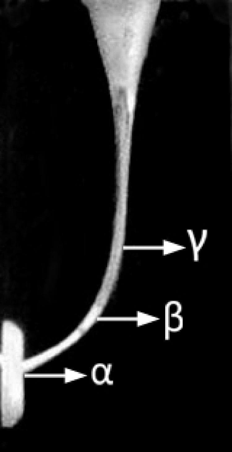 This diagnostic image displays a monochrome view of a simulated root canal structure, likely used for endodontic research or education. The visual demonstrates the morphology of a curved canal, tapering from a wider coronal aspect toward a narrow apical region. Three critical anatomical reference points are identified using Greek letters: Gamma (̸) indicates the most coronal portion of the curvature, Beta (̲) marks the middle section of the canal along the outer curvature, and Alpha (̱) denotes the apical end near the termination point. The canal exhibits a distinct lateral deflection, characteristic of natural root canal anatomy. This material serves as a model for evaluating dental instrumentation techniques, canal preparation efficiency, and the maintenance of canal centering during biomechanical preparation.