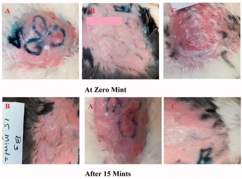 This comparison clinical photograph depicts the efficacy of topical antihistamine formulations on induced skin reactions in a rabbit model. The visual is organized into two rows representing time points: 'At Zero Mint' and 'After 15 Mints', subdivided into three experimental groups (A, B, and C). Group A evaluates a novel Ebastine emulgel, Group B serves as a positive control using a standard antihistamine (Benadryl), and Group C acts as the untreated negative control. At 0 minutes, all groups show histamine-induced erythema and wheal formation, with Group C exhibiting the most severe, raised, and inflamed lesion. Surface markings in blue and pink demarcate treatment zones. At 15 minutes, Group A and Group B demonstrate a visible reduction in the intensity and area of erythema, indicating effective drug absorption and inhibition of the H1-receptor-mediated allergic response. In contrast, Group C maintains significant, persistent inflammation and redness. The images illustrate the clinical progression of allergic skin lesions and the therapeutic effect of topical emulgel formulations on inflammatory symptoms like redness and swelling.