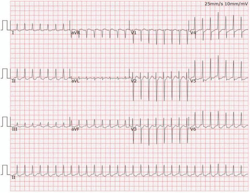 Hugging Face pmc clinical VQA raw