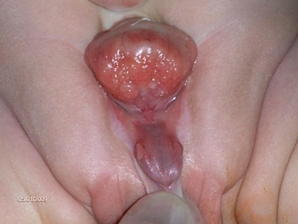 Hugging Face pmc clinical VQA raw