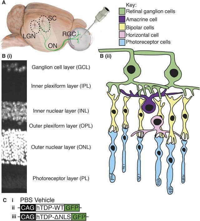 This composite educational graphic details the neuroanatomy and experimental modeling of the mammalian visual system. Panel A features an anatomical diagram of an eye model and brain, illustrating an intravitreal injection. It highlights retinal ganglion cells (RGCs) extending axons through the optic nerve (ON) to the lateral geniculate nucleus (LGN) and superior colliculus (SC). Panel B(i) shows a diagnostic DAPI-stained histological cross-section of the retina, identifying six distinct layers: Ganglion cell layer (GCL), Inner plexiform layer (IPL), Inner nuclear layer (INL), Outer plexiform layer (OPL), Outer nuclear layer (ONL), and Photoreceptor layer (PL). Panel B(ii) provides a matching color-coded cellular schematic showing the vertical and horizontal organization of RGCs (green), amacrine cells (purple), bipolar cells (yellow), horizontal cells (pink), and photoreceptors (blue). Panel C lists experimental genetic constructs (PBS vehicle, hTDP-WT, and hTDP-ΔNLS tagged with GFP) used for disease modeling. This visual resource is designed for intermediate to advanced study of ocular anatomy, histopathology, and neurodegenerative disease research methodology.