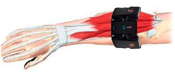 This medical illustration depicts an anatomical diagram of the human forearm and hand with a superimposed wearable surface electromyography (sEMG) device. The underlying anatomy displays the radius and ulna bones, the carpal and metacarpal structures, and the phalanges in white. The musculature of the posterior (extensor) compartment is rendered in red, with tendons highlighted in white crossing the wrist joint beneath the extensor retinaculum. A segmented black armband containing eight dry electrodes is shown positioned on the proximal third of the forearm, approximately one finger-width distal to the elbow joint. The electrodes are numbered, with electrode '1' aligned dorsally with the middle finger, while electrodes '2' and '8' are visible laterally. This visual serves as a technical and anatomical protocol for sensor placement in gesture recognition research, emphasizing the relationship between electrode orientation and underlying superficial muscles and tendons.