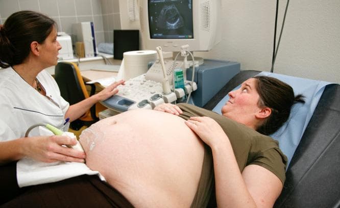 This clinical photograph illustrates a procedural setup for an obstetric ultrasound examination. The patient, a pregnant woman with a distended abdomen, is positioned supine on an examination table. A healthcare professional, positioned to the patient's right, is performing the scan using a curvilinear ultrasound transducer. A translucent coupling gel is visible on the lower abdominal region to facilitate acoustic transmission. The ultrasound machine's monitor is positioned at the patient's head level, displaying a real-time sonographic image of the fetus. The image demonstrates key aspects of maternal care and diagnostic imaging in obstetrics. Noteworthy anatomical features include the gravid uterus and striae gravidarum (stretch marks) on the abdominal skin. The clinical context relates to prenatal monitoring, fetal health assessment, and the study of maternal factors, such as obesity or insulin resistance, that may influence pregnancy and postpartum outcomes like lactation.