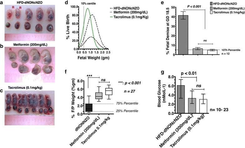 This composite educational graphic details fetal outcomes in a mouse model of gestational diabetes mellitus (GDM), comparing untreated High-Fat Diet (HFD-dNONcNZO) dams to those treated with Metformin or Tacrolimus. Panels (a-c) provide clinical photographs of fetuses at gestational day 18.5; untreated dams (a) show significantly higher rates of fetal resorption (labeled 'R') and smaller, poorly preserved fetuses compared to the larger, more numerous, and intact fetuses in the Metformin (b) and Tacrolimus (c) groups. Panels (d-g) present quantitative data confirming these findings. Graph (e) shows a statistically significant increase in percentage of fetal demise in the untreated group (p < 0.001). Panel (f) illustrates a lower fetal-to-placental (F/P) weight ratio in untreated dams, indicating impaired placental efficiency. Panel (g) records significantly elevated blood glucose levels in untreated offspring (p < 0.01) compared to the normalized levels in treated groups. The content demonstrates the therapeutic potential of Tacrolimus and Metformin in reducing hyperglycemia-induced fetal morbidity and mortality.