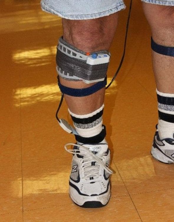 Clinical photograph of a patient's lower limb demonstrating the application of the Walkaide® Functional Electrical Stimulation (FES) system, an orthotic device designed to address foot drop. The device features a battery-operated electronic stimulator unit housed in a white rectangular casing, mounted onto a molded gray and silver textured cuff. This cuff is positioned circumferentially on the proximal lower leg, just below the knee, specifically targeting the lateral aspect near the fibular head to stimulate the common peroneal nerve. A dark blue secondary strap provides additional stabilization below the main unit. A thin black lead wire descends from the stimulator unit to a silver surface electrode positioned near the ankle. The system utilizes tilt sensors and accelerometers to deliver electrical impulses to the dorsiflexor muscles during the swing phase of gait. The image captures the device in a clinical or rehabilitative setting, illustrating the integration of assistive technology with daily wear, including athletic footwear and socks.